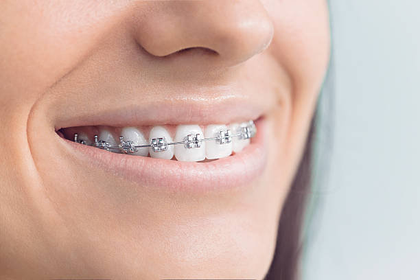 Best Root Canal Treatment  in Litchfield, IL